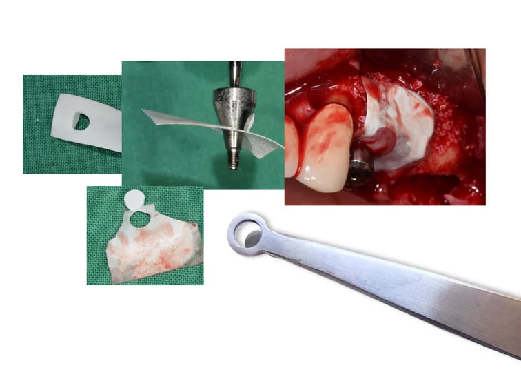 Membrane Hole Punch (2 mm / 4 mm / 5 mm)