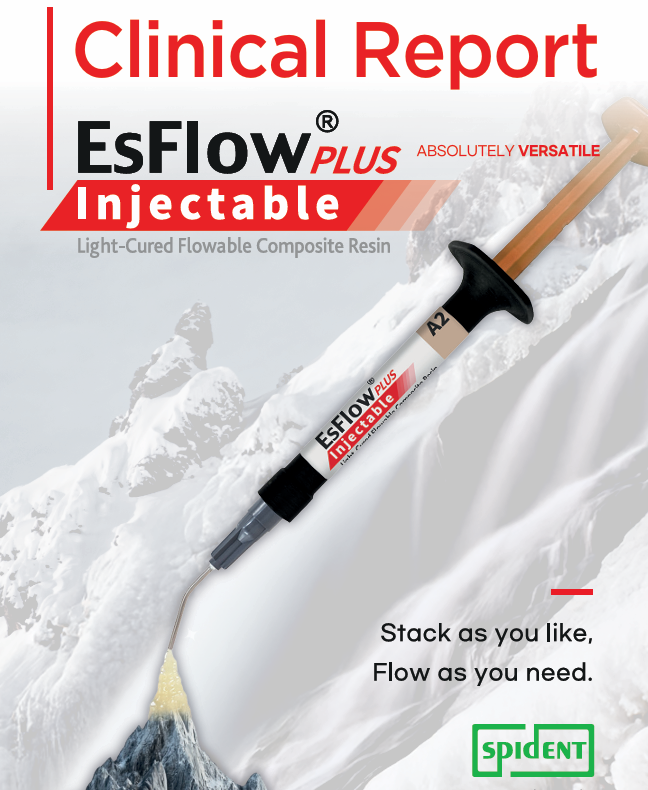 Why Injectable Flowables Are Changing Modern Restorative Dentistry