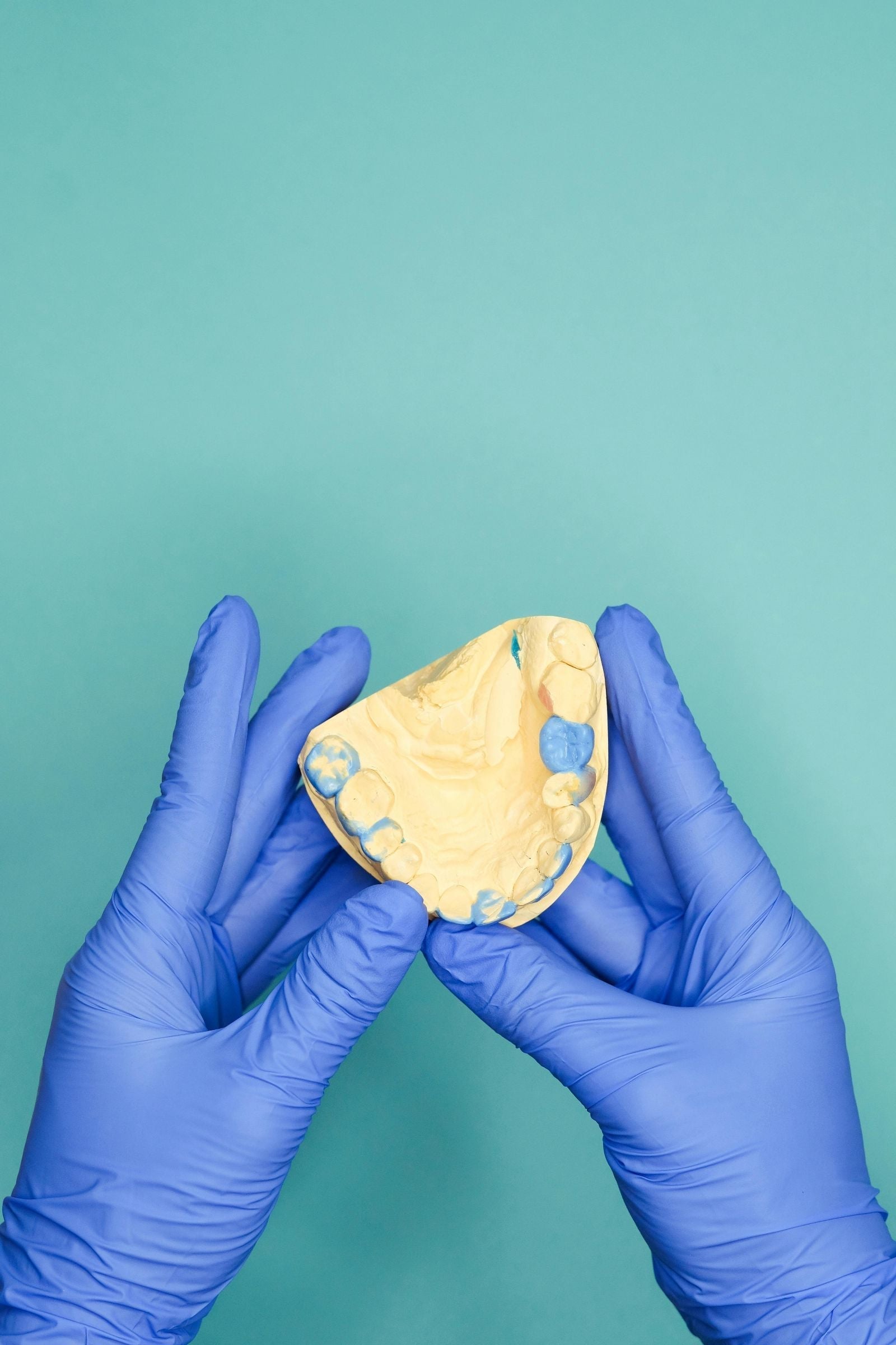 How to Reduce Impression Remakes in Daily Practice