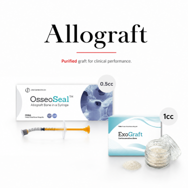 Allograft