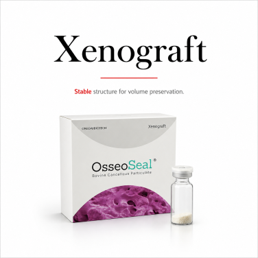 Xenograft