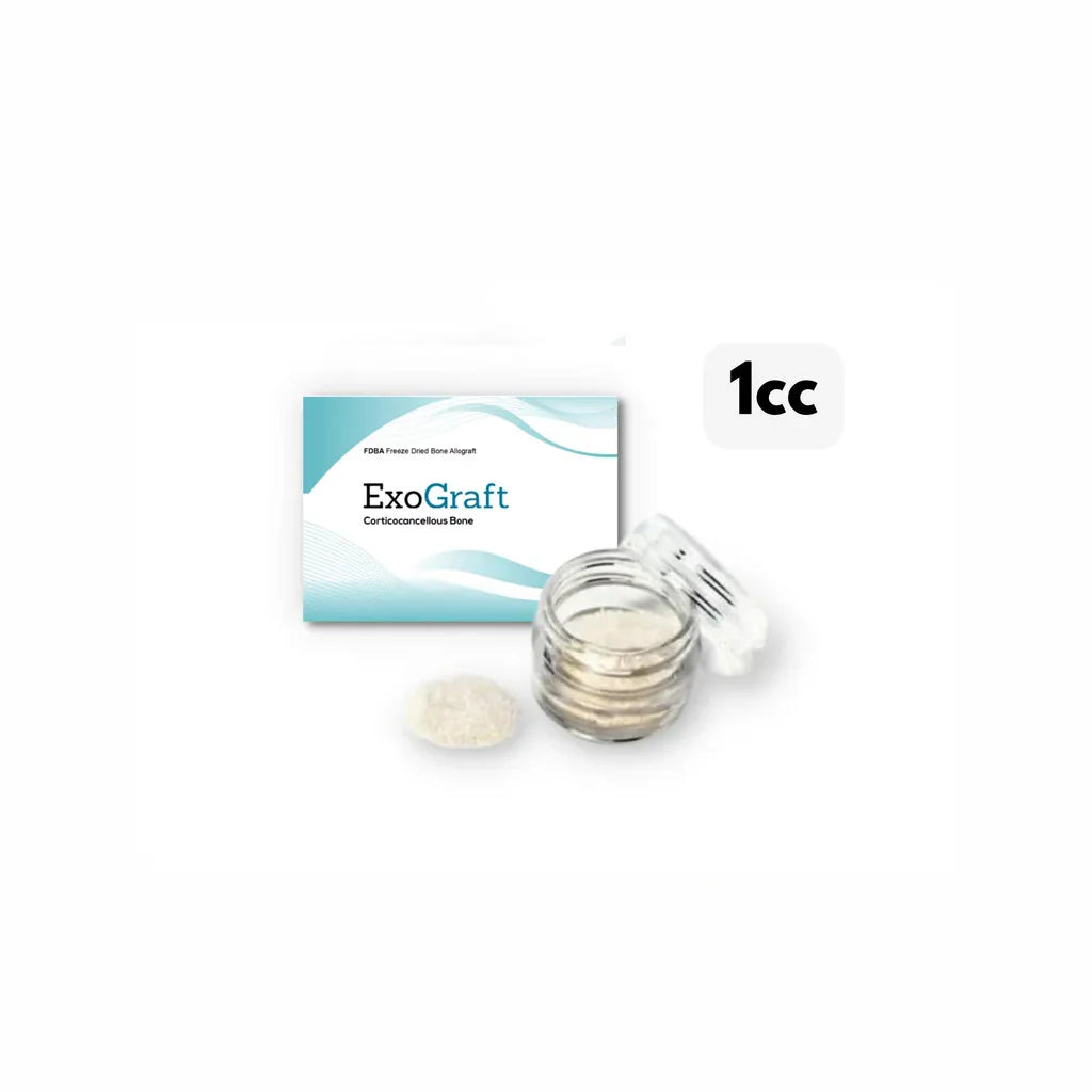 Freeze-Dried Bone Allograft (FDBA) — 1 cc (250–1000 µm)