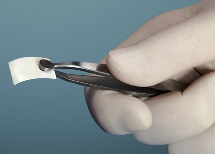 Membrane Hole Punch (2 mm / 4 mm / 5 mm)