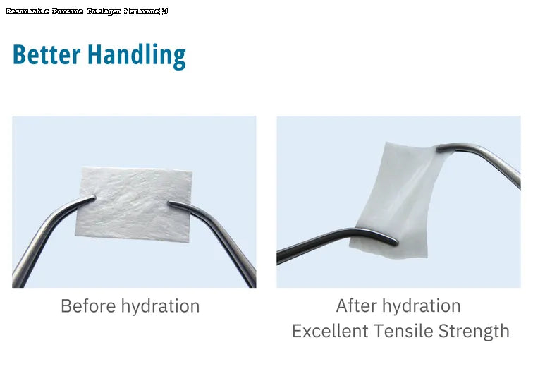 OsseoSeal™ Collagen Membrane (Pericardium)